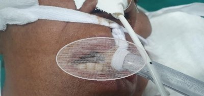 Coren/RO denuncia insalubridade no Hospital de Campanha da Zona Leste em Porto Velho;...