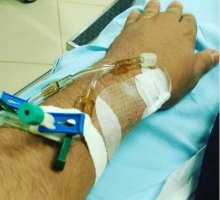 Em pouco mais de 2 anos, cerca de 3 mil pessoas morreram por complicações de câncer em...