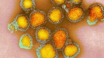 Sesau confirma quatro novas mortes por Influenza em Rondônia; Total já chega a 8 apenas...