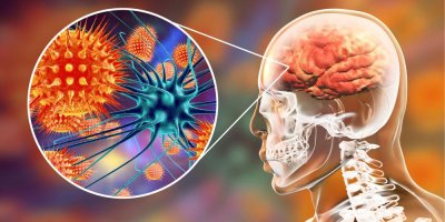 Adolescente de 14 anos com meningite tem morte cerebral em hospital de Cacoal