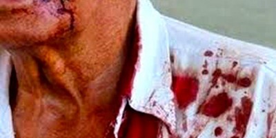 ABSURDO: Idoso é hospitalizado após ser agredido por filho