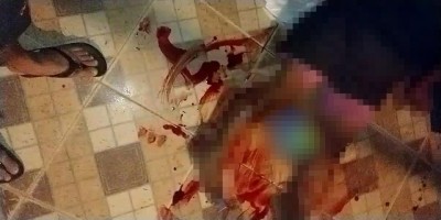 JI-PARANÁ: Mulher sofre tentativa de homicídio a tiros