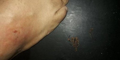 Homem é picado por escorpião em cinema