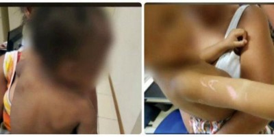 Polícia fecha cerco contra pai por tentar degolar bebê