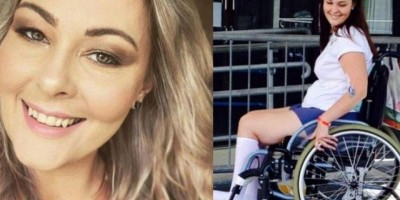 Mulher quase morre após usar pincel de maquiagem emprestado