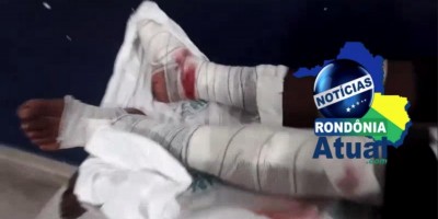 Imagens Fortes: Acidente deixa três pessoas em estado grave em Ji-Paraná
