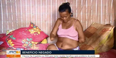 Mulher sem mãos e pernas tem pedido de benefício negado pelo INSS por não poder...
