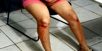 Mulher é espancada e arrastada pelos cabelos na rua pelo ex-marido em Porto Velho