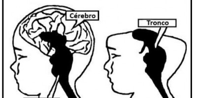 Jaru: Defensoria Pública consegue ação de interrupção de gravidez à mãe de bebê...