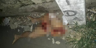 Imagens fortes: Pernas de mulher são encontradas jogadas em calçada de beco em Manaus;...