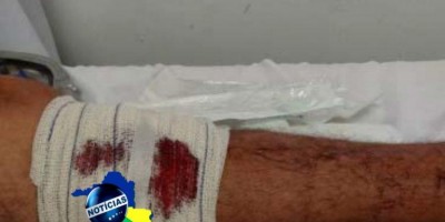 Homem é vítima de tentativa de homicídio em Ji-Paraná