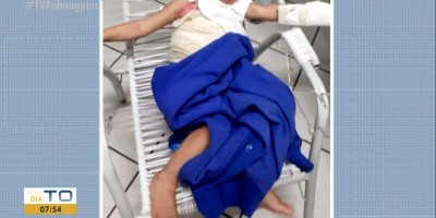 Bebê sofre queimadura com água fervente em metade do corpo e aguarda vaga em UTI...
