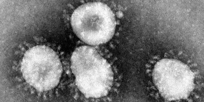 Governo de MG investiga suposto caso de coronavírus; doença respiratória mata 17 na...