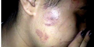 Adolescente é surrada após beber em bar que foi a procura do marido