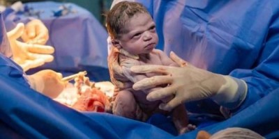 Bebê nasce 'brava' e foto viraliza: 'Nasceu um meme pronto', diz mãe