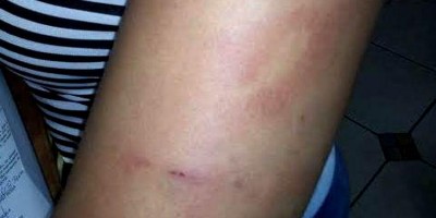 Com ciúmes da cunhada, marido ataca esposa a pauladas em apartamento