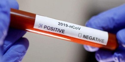 Ministério da Saúde confirma 3º caso de coronavírus no Brasil