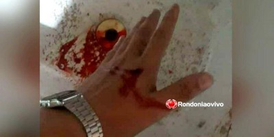 Bandidos agridem e tentam matar estudante a tiros durante assalto em Porto Velho