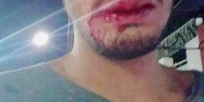 Recepcionista é agredido por oito venezuelanos em hotel de Porto Velho