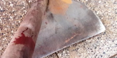 Filho tenta matar pai com golpes de enxada, em Ouro Preto do Oeste