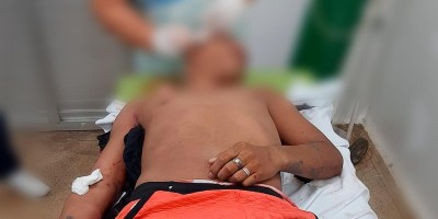 Homem é morto com tiro na cabeça, após voltar de festa no Amazonas