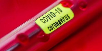 Casos suspeitos de coronavírus aumentam 40% no Brasil e sobe para 930 com 25...