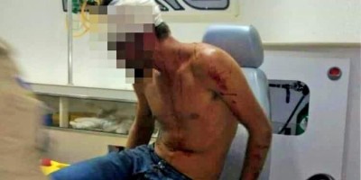 Homem leva paulada de mulher após não querer dividir droga com ela em Guajará-Mirim