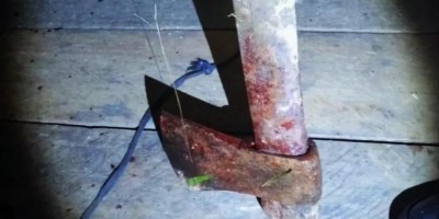 Filho tenta matar o pai de 68 anos a machadadas no Amazonas