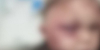 Bebê é espancado e entra em coma; padrasto é suspeito de agressão