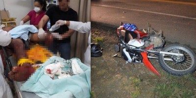 Motociclista tem perna decepada em ultrapassagem na BR-364 em Jaru