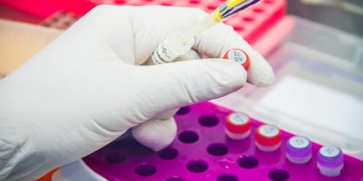 Agevisa atualiza para 114 casos suspeitos em 14 municípios de RO e 01 caso confirmado em...