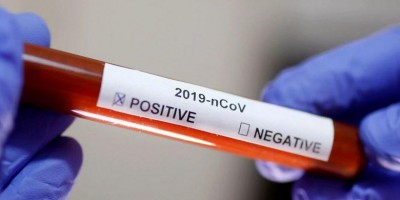 Brasil tem 34 mortes e 1.960 casos confirmados de coronavírus