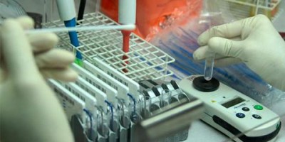 Exames para coronavírus não estão sendo feitos pelo Lacem/RO desde quinta-feira por...