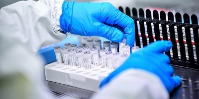 Teste de vacina contra o coronavírus produz anticorpos em ratos nos EUA