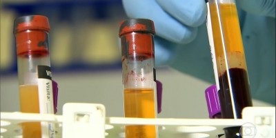 Tratamento contra coronavírus que usa sangue de pacientes curados está sendo testada no...