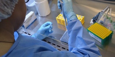 Sesau diz que kits para exame de Covid-19 no Lacen de Rondônia acabaram