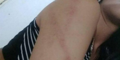 Mulher é agredida a cadeirada pelo marido que usava droga em casa