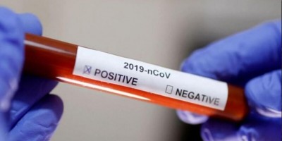 Ouro Preto confirma primeiro caso de Covid-19