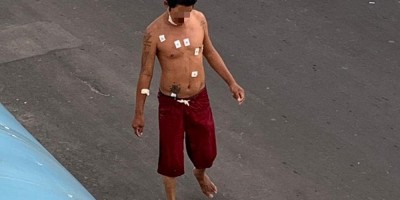 Internado com Covid-19, morador de rua foge de hospital e pega mototáxi no interior do...