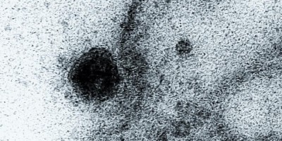 Imagens inéditas mostram coronavírus atacando células do corpo humano registrada por...