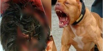 Ladrão é hospitalizado após invadir residência e ser atacado por pitbull