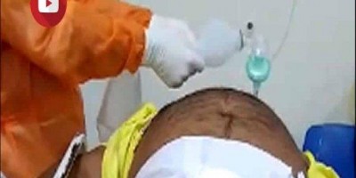 Respirador não funciona e técnica faz respiração manual em paciente