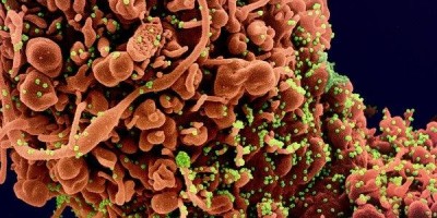 Autópsias em SP encontram coronavírus no cérebro; danos são estudados