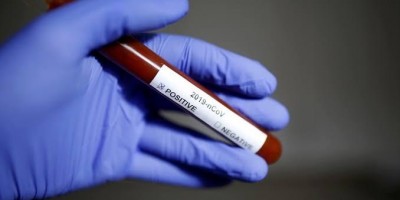 Sesau confirma mais 3 mortes por Covid-19 e total sobe para 14 em Rondônia