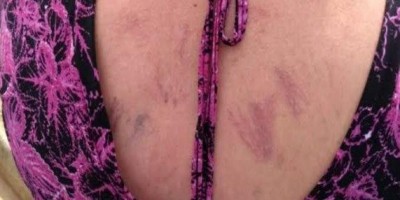 Por demorar fazer o almoço, jovem é espancada pelo irmão em Porto Velho