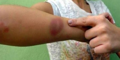 Marido agride e expulsa mulher de casa na frente da filha