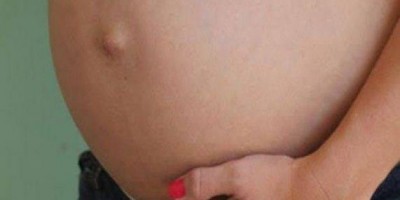 Grávida de nove meses é agredida com chutes pelo marido