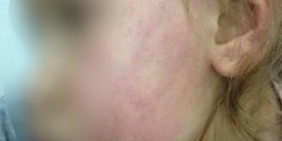 Criança com sede pede água para beber e recebe tapa no rosto em Porto Velho