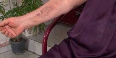 Idosa é espancada por trio ao tentar defender a neta