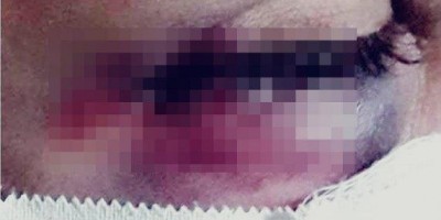 Dona de casa é surrada, mas, por amor, tenta impedir prisão do marido